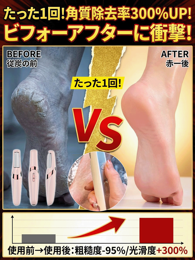コードレス電動角質リムーバー