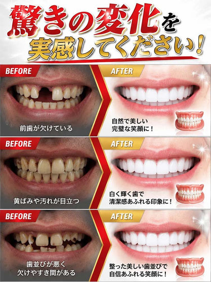 カスタマイズマウスピースセット