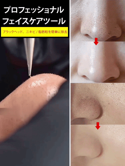 ステンレス 黒ずみ＆角栓ケアピンセット